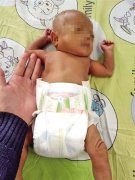 新生儿早产仅1.6斤 如今已经4斤多