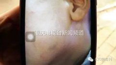 10岁重庆娃儿一句脏话 招来一顿耳光