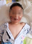 3岁男童坐副驾出事了：安全气囊将他的脸打变形