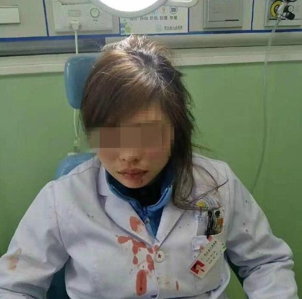 女医生指错路被病人家属打骨折?警方:已介入调查