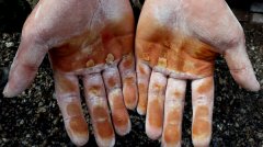 重庆90后武警战士一手老茧，掉皮见肉让人心疼