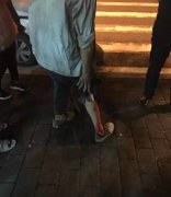 重庆惊现恶犬 咬过十余人咬了就跑
