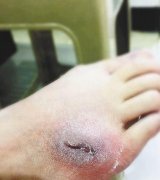 女子乘轨交被高跟鞋踩伤 索赔时对方却关机