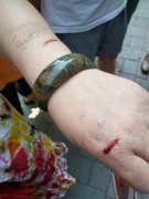 一把水果刀从天而降  划伤女子手臂