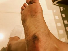 新买的凉鞋穿后脚变煤球  商场柜员：正常现象