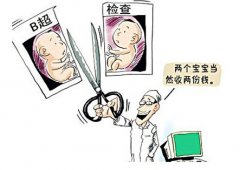 女子怀双胞胎做B超检查 被要求收取双倍费用