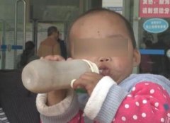 三岁女孩张不开嘴 靠喝奶粉米粉长大