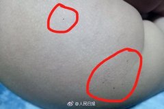 北京红黄蓝幼儿园被曝虐童 重庆也有12家红黄蓝幼儿园