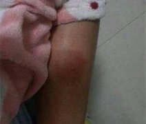 小伙骑三轮撞伤小孩 家长未要赔偿遭家人斥责