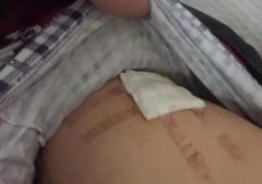 重庆的哥拉客起纠纷 被黑车司机捅伤