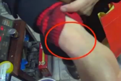 女子被猫咬伤要求赔偿 猫主人却称其是骗子