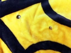 阳台晾晒的被套  竟被烧出两个大黑洞