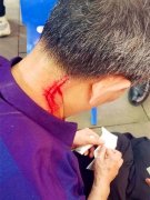 天降窗户落地解体 男子被砸中鲜血直流