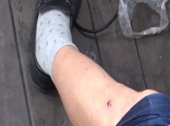 男子街头被狗咬伤  狗主人却不认账