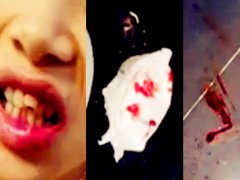 孕妇酒店房内摔断牙 倒地不起地上撒泼