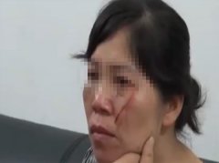 买卖不成   女子还被“毁了容”