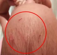 飞来横祸！小区电梯顶棚突然掉落砸中七个月大的小孩